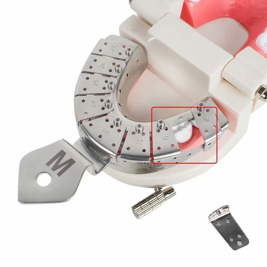 Detachable impression Tray for Implants