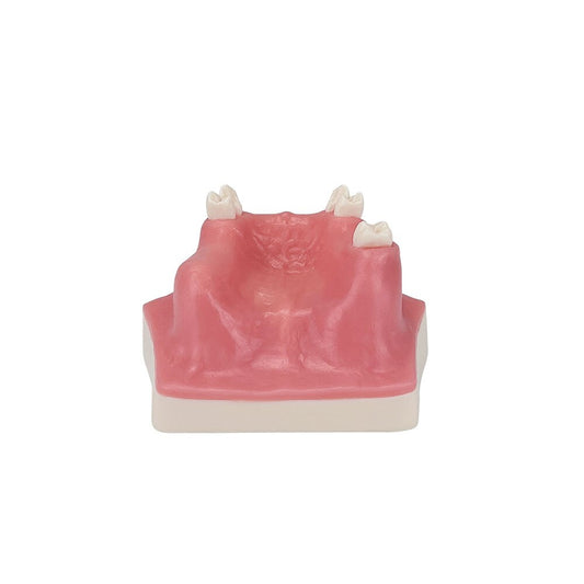 Dental Implant Teaching Model Maxillary Sinus Teeth Model for Dentist Student Practice Studying Oral Medical Communication Tools