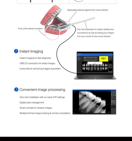 Digital Intraoral X Ray sensor