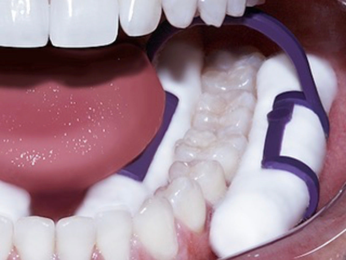 Cotton Roll Holders - Rubber Dam Alternative