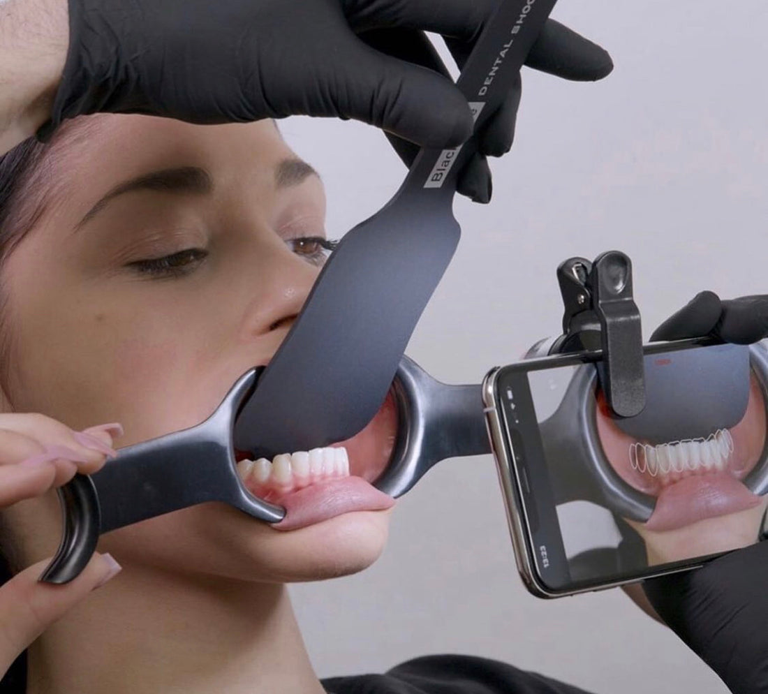 4PCS Black Double Head Lip Retractors