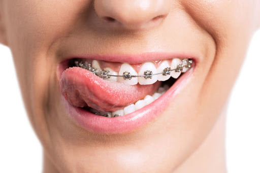 Orthodontics