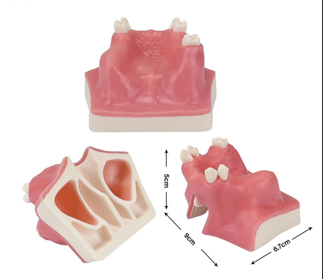 Dental Implant Teaching Model Maxillary Sinus Teeth Model for Dentist Student Practice Studying Oral Medical Communication Tools