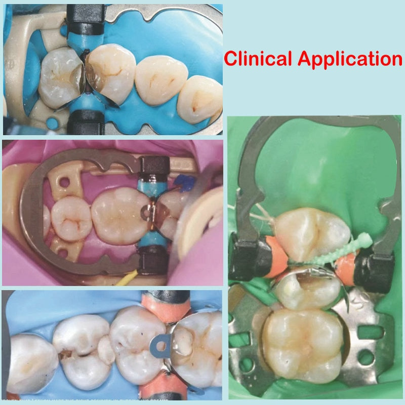 Garrison Dental Composi-Tight 3D Sectional Matrix System Kit Garrison Dental Composi-Tight 3D Sectional Matrix System Kit