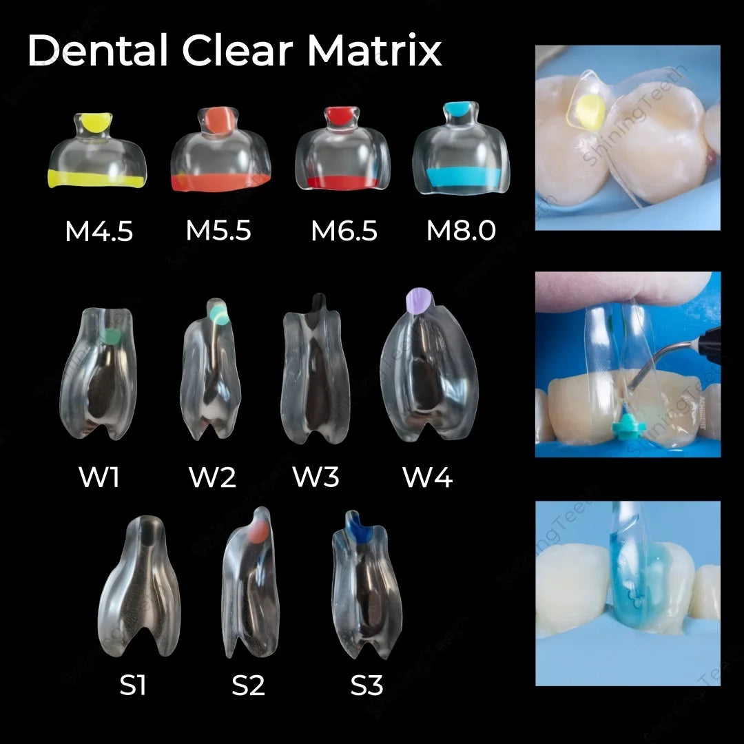 Clear Matrix BT Bow Matrices (10-Pack) – Transparent Dental Matrices for Anterior & Posterior Composite Restorations