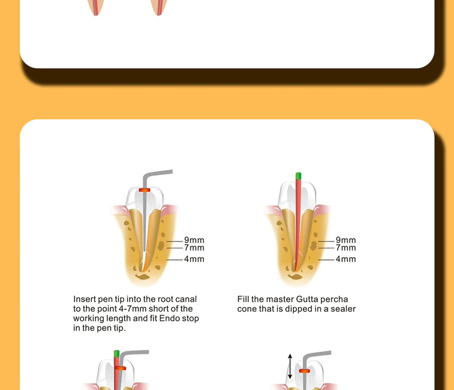 Gutta Percha Obturation System with 2 Tips