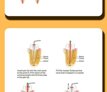 Gutta Percha Obturation System with 2 Tips