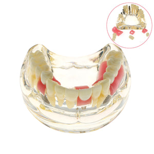 Teeth models / typodonts