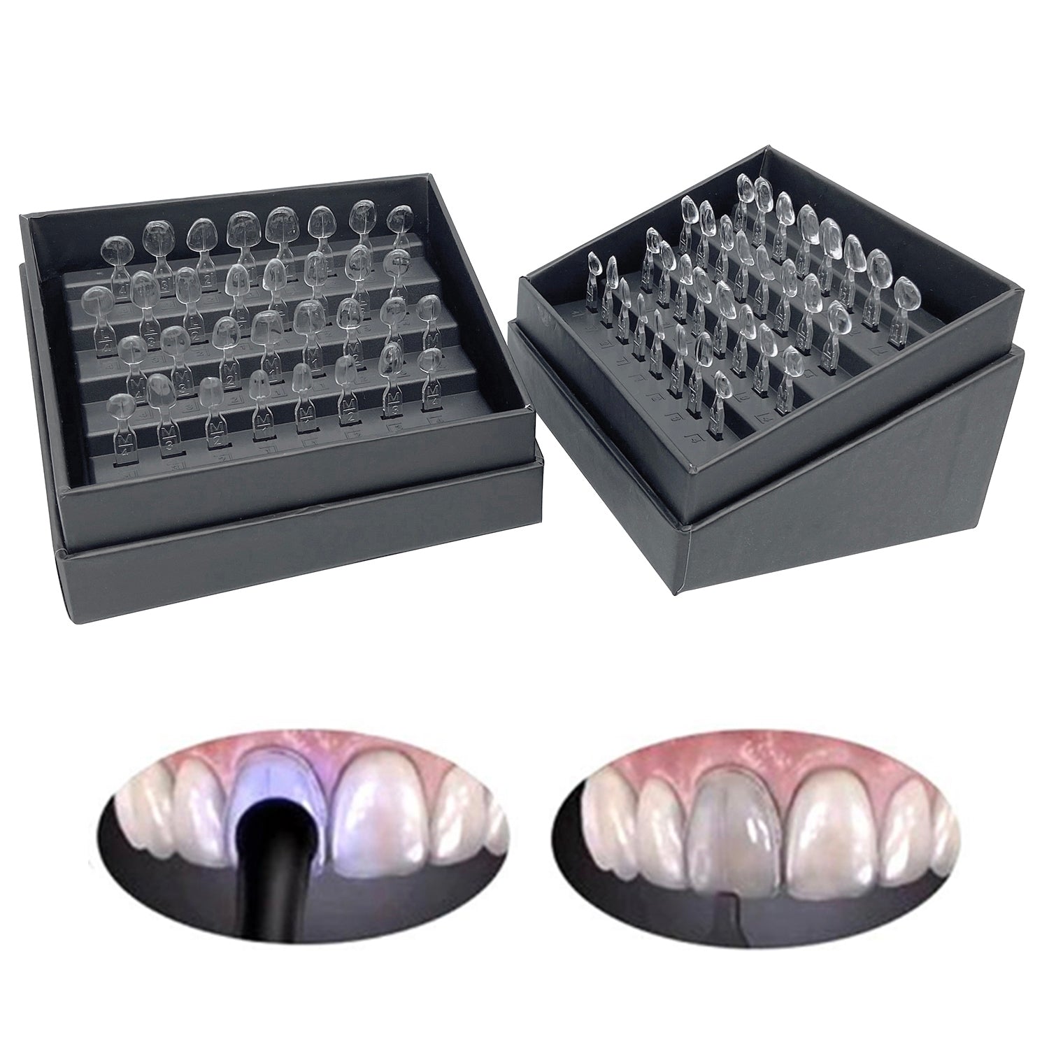 32pcs/Set Dental Veneer Mould Kit Composite Resin Mold Light Cure Auto –  iDentalShop