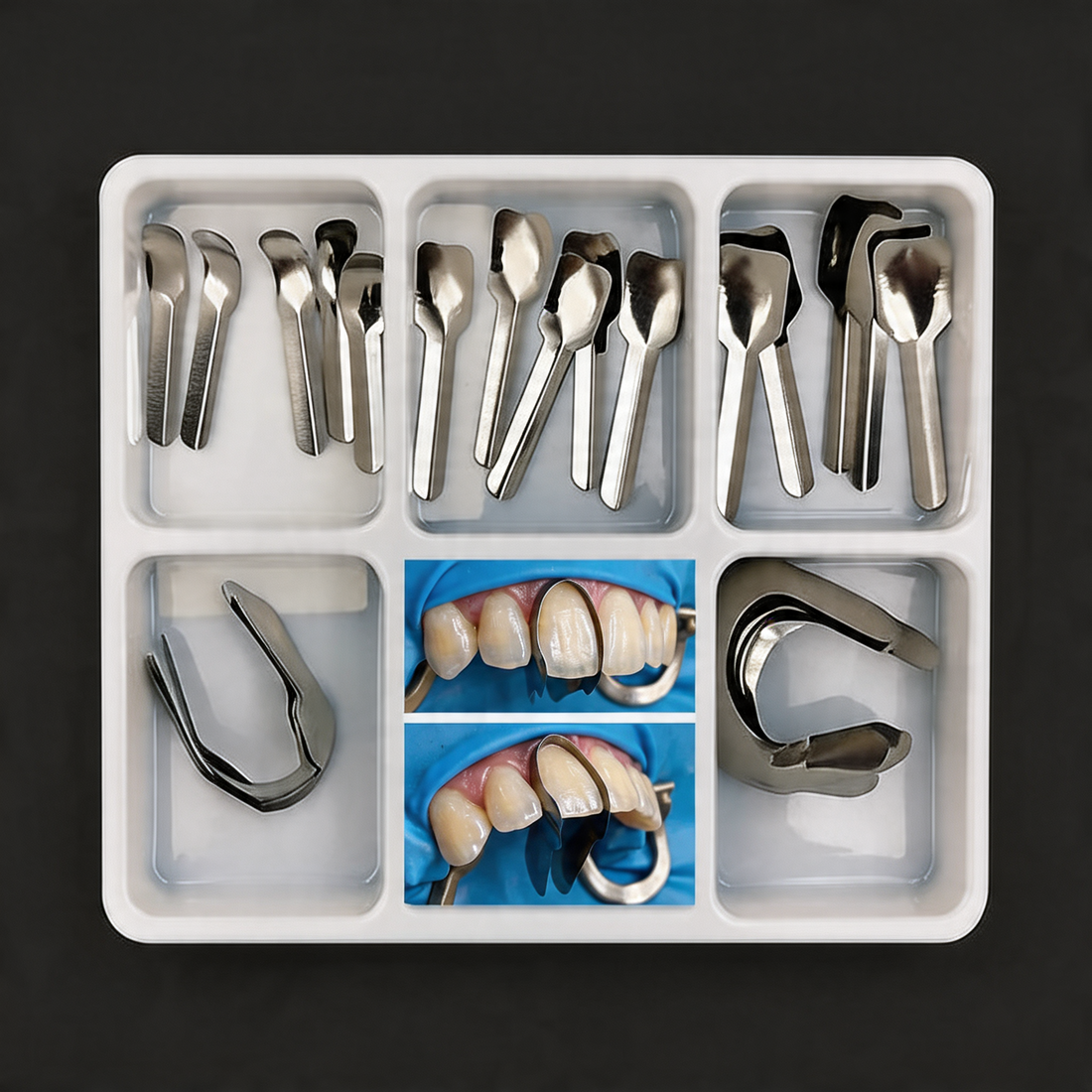 Anterior Sectional Matrices for Composites – image 2