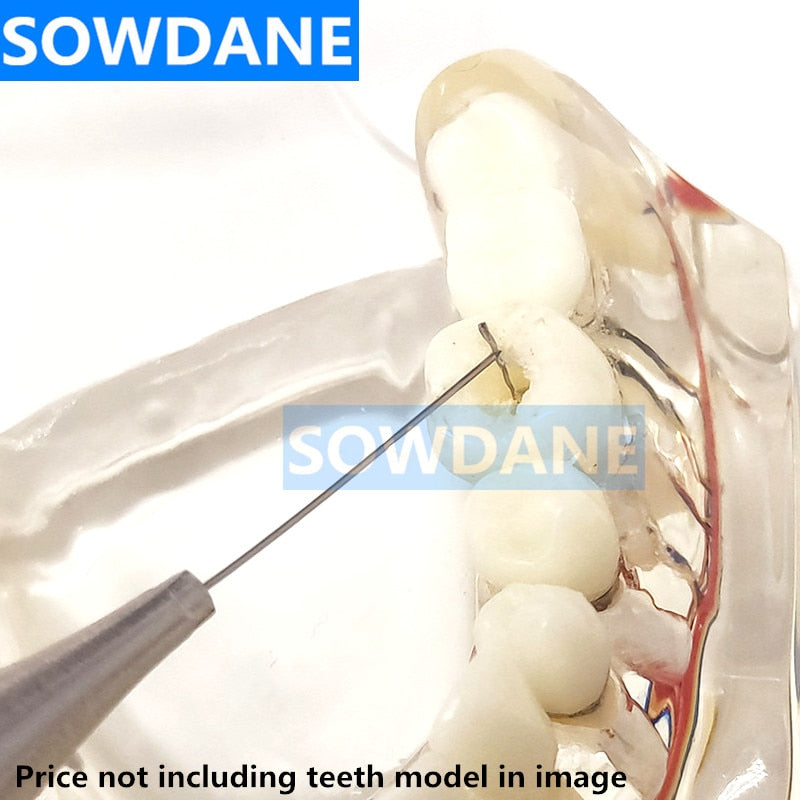 Root Canal - Broken File Extractor