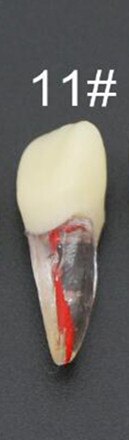 Endo Training Block / Tooth Root Canal Model For RCT Practice