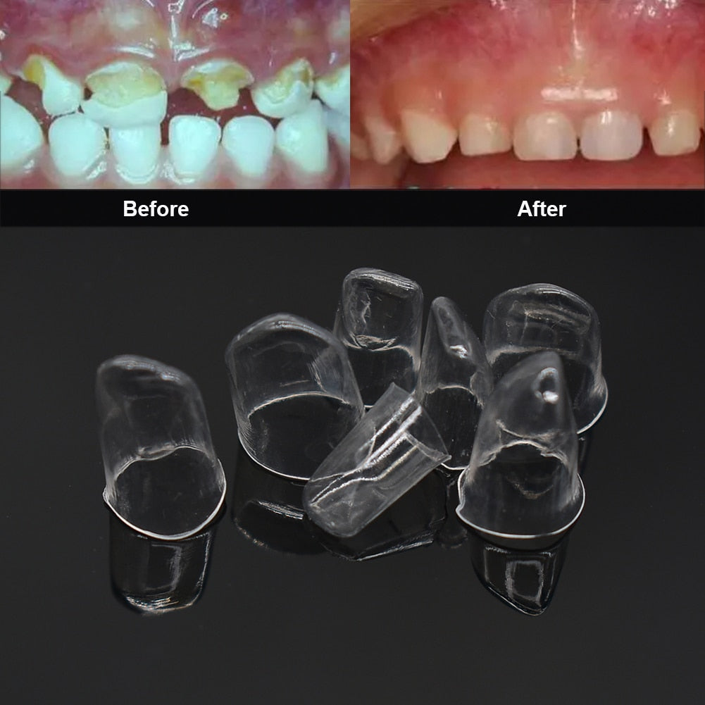 64pcs Dental Anterior Transparent Crowns
