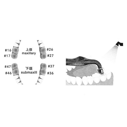 Posterior teeth molds