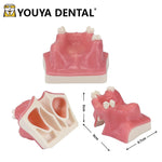 Dental Implant Teaching Model Maxillary Sinus Teeth Model for Dentist Student Practice Studying Oral Medical Communication Tools