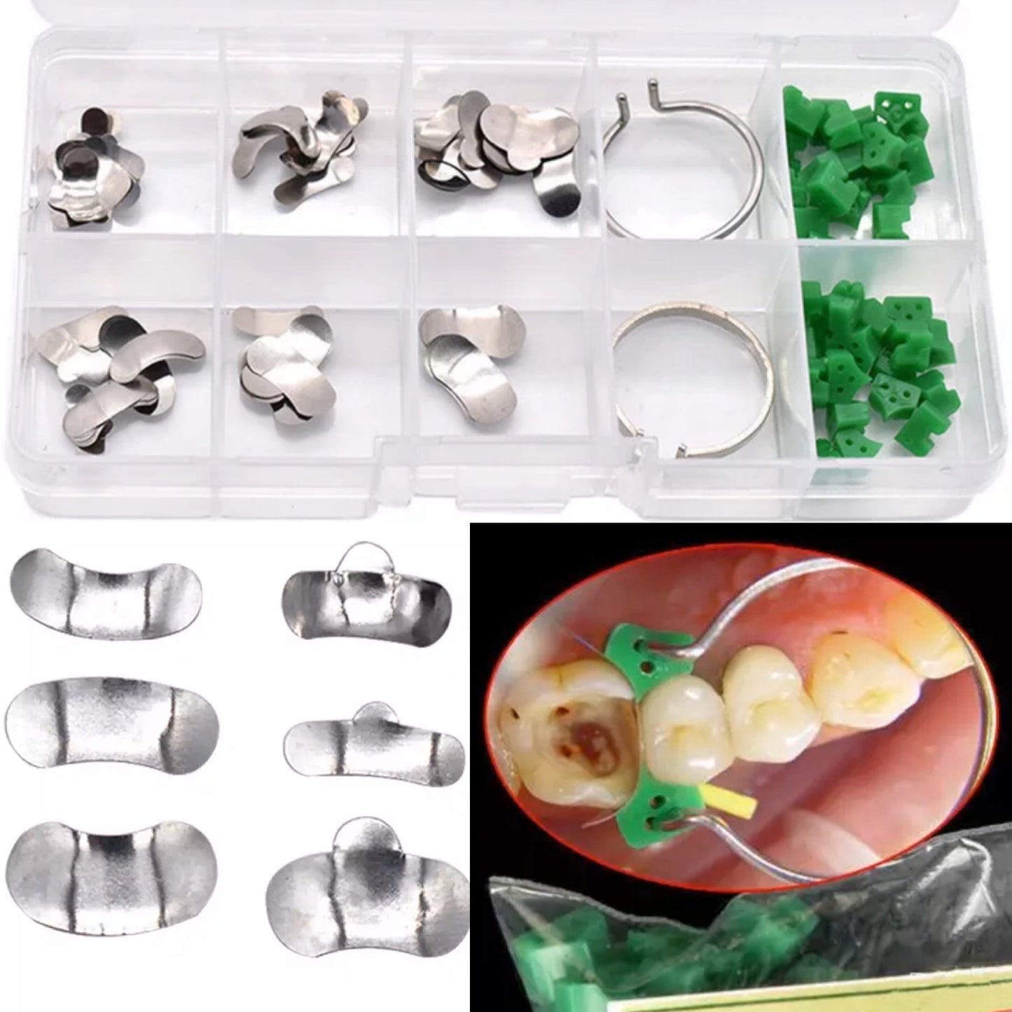 Sectional Dental Matrix With Springclip