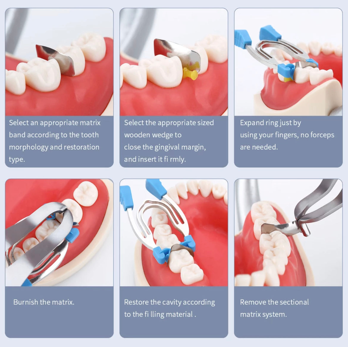 Sectional Matrices Kit