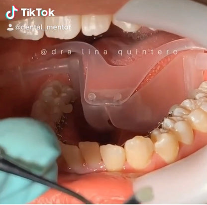 Dental Retractor / Dry Field System