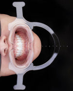 Lip Retractor With Handles For Dental Photography