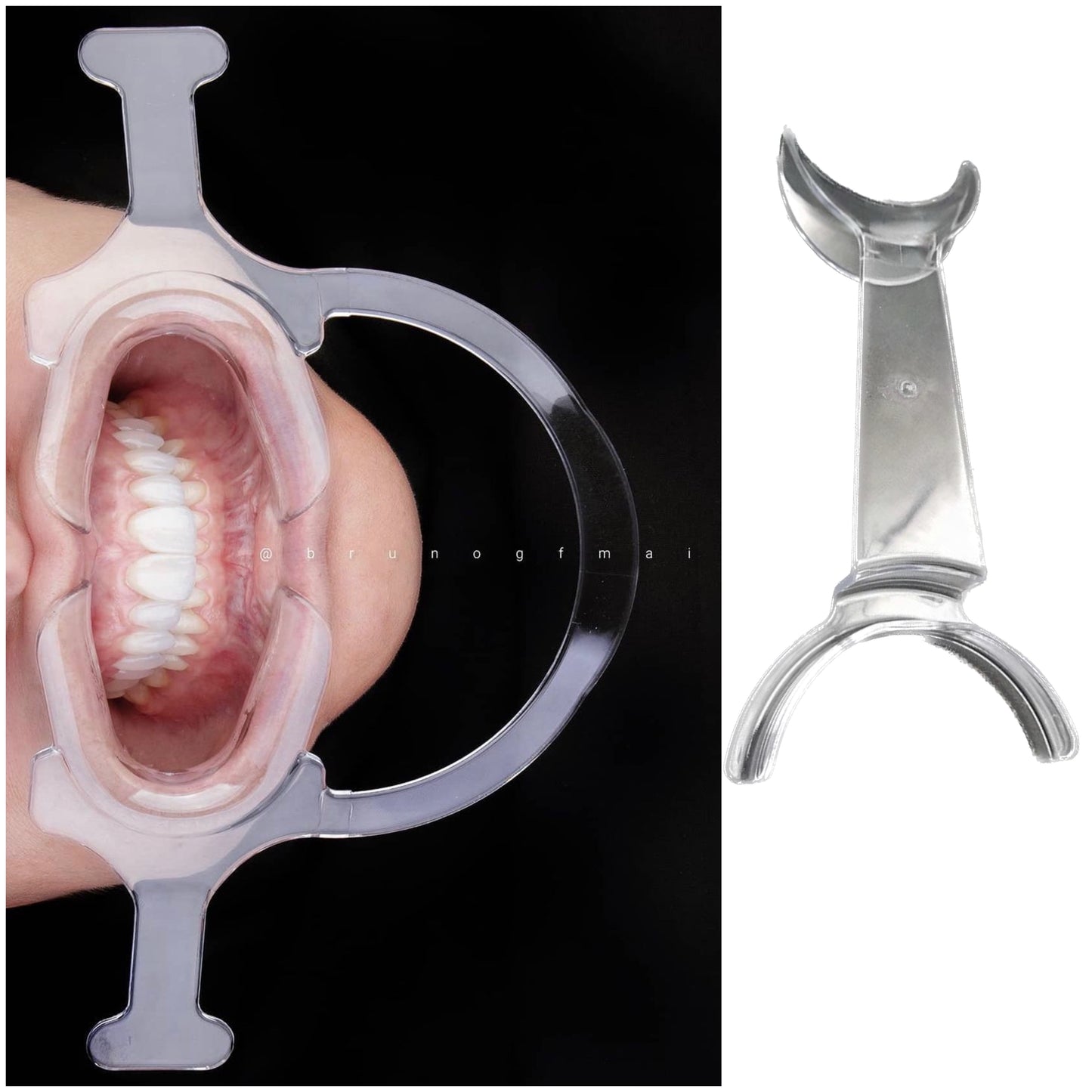 Anti-Fog Mirror System For Dental Photography