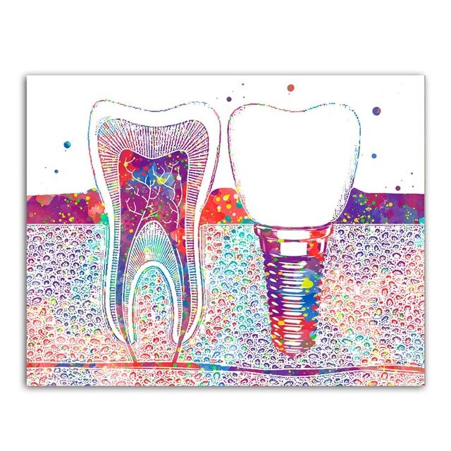 Dental ART Poster/canvas