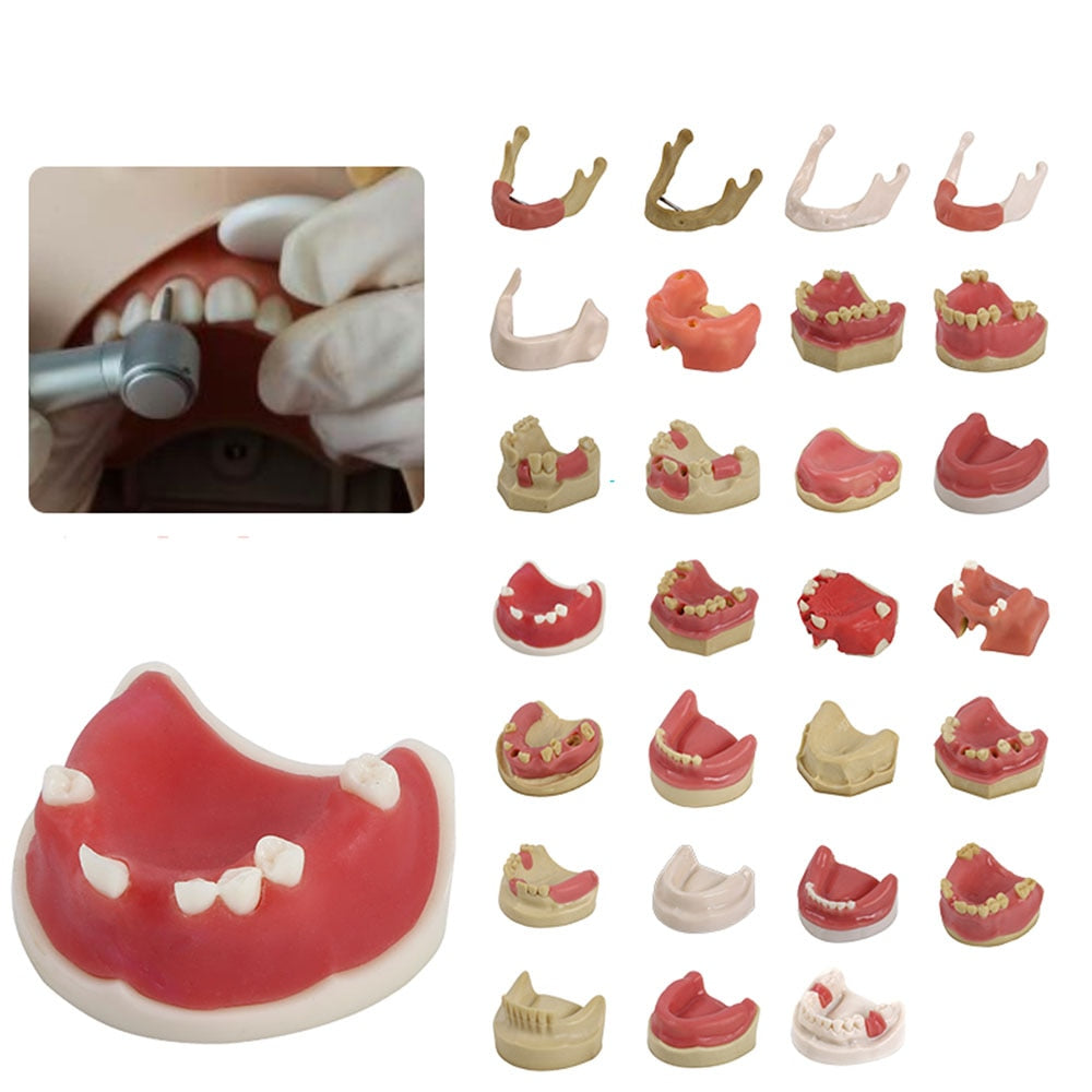 Oral Tissue/Jaw  Models For Practise / FREE Global Delivery