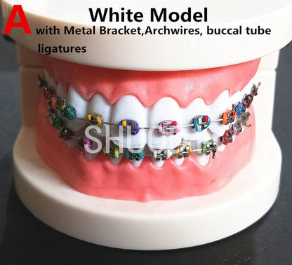 Teeth Models with Braces