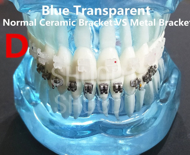 Teeth Models with Braces