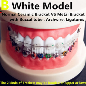 Teeth Models with Braces