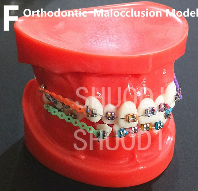 Teeth Models with Braces