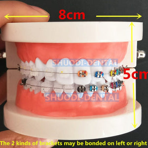 Teeth Models with Braces