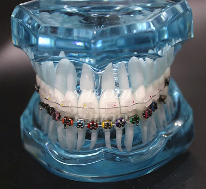 Teeth Models with Braces