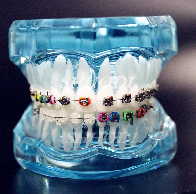 Teeth Models with Braces