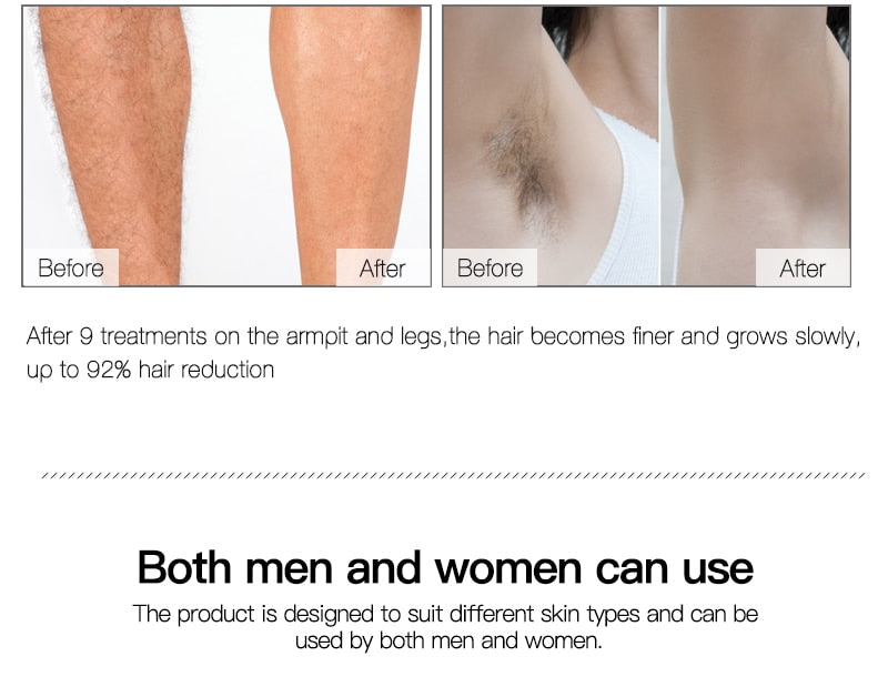 Premium Painless Laser Hair Removal