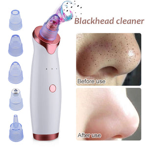 Black Spot/Pore Remover - Vacuum Skin Cleaner