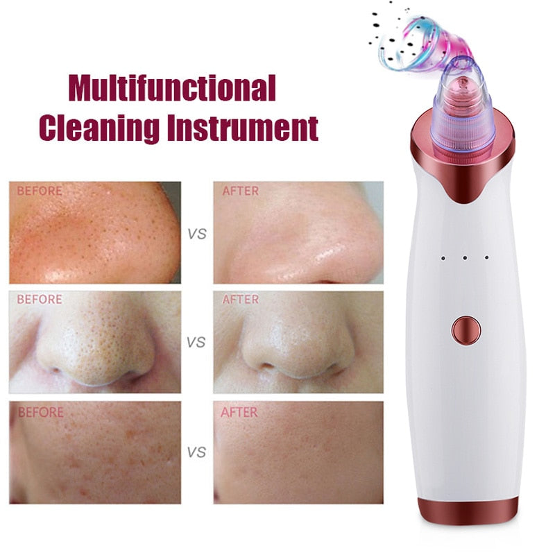 Black Spot/Pore Remover - Vacuum Skin Cleaner