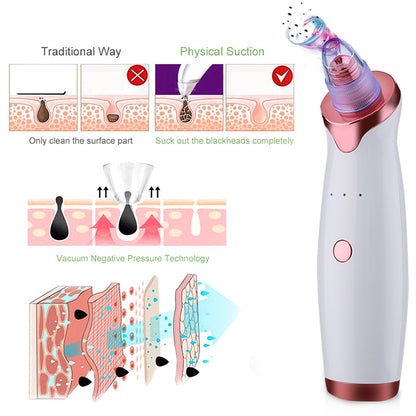 Black Spot/Pore Remover - Vacuum Skin Cleaner