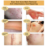 Acne Scar Removal Gel