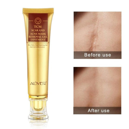 Acne Scar Removal Gel