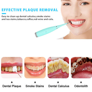 Dental Scaler / Plaque Remover