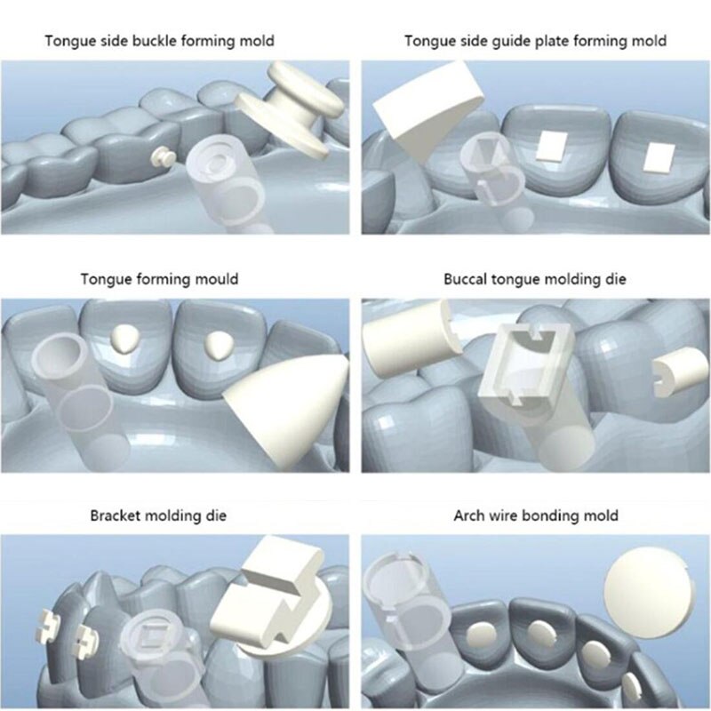 Lingual Button/Bite Turbo/Tongue Tamer/Mini Tube/Brackets/Lingual Wire Mold Kit. Orthodontic