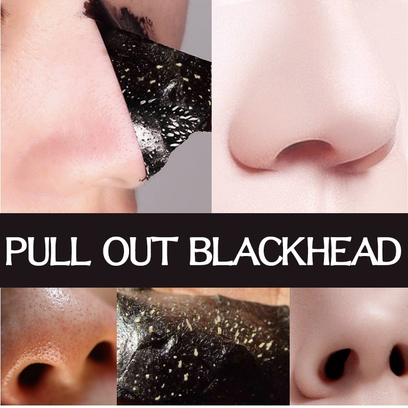 5 Black Face Masks - Acne Therapy - Blackhead Remover FREE GLOBAL DELIVERY