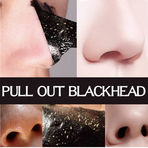 5 Black Face Masks - Acne Therapy - Blackhead Remover FREE GLOBAL DELIVERY