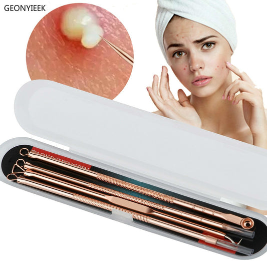 Rose Gold 4pcs/set Blackhead Comedone Acne Pimple Belmish Extractor / Blackhead Remover FREE GLOBAL DELIVERY