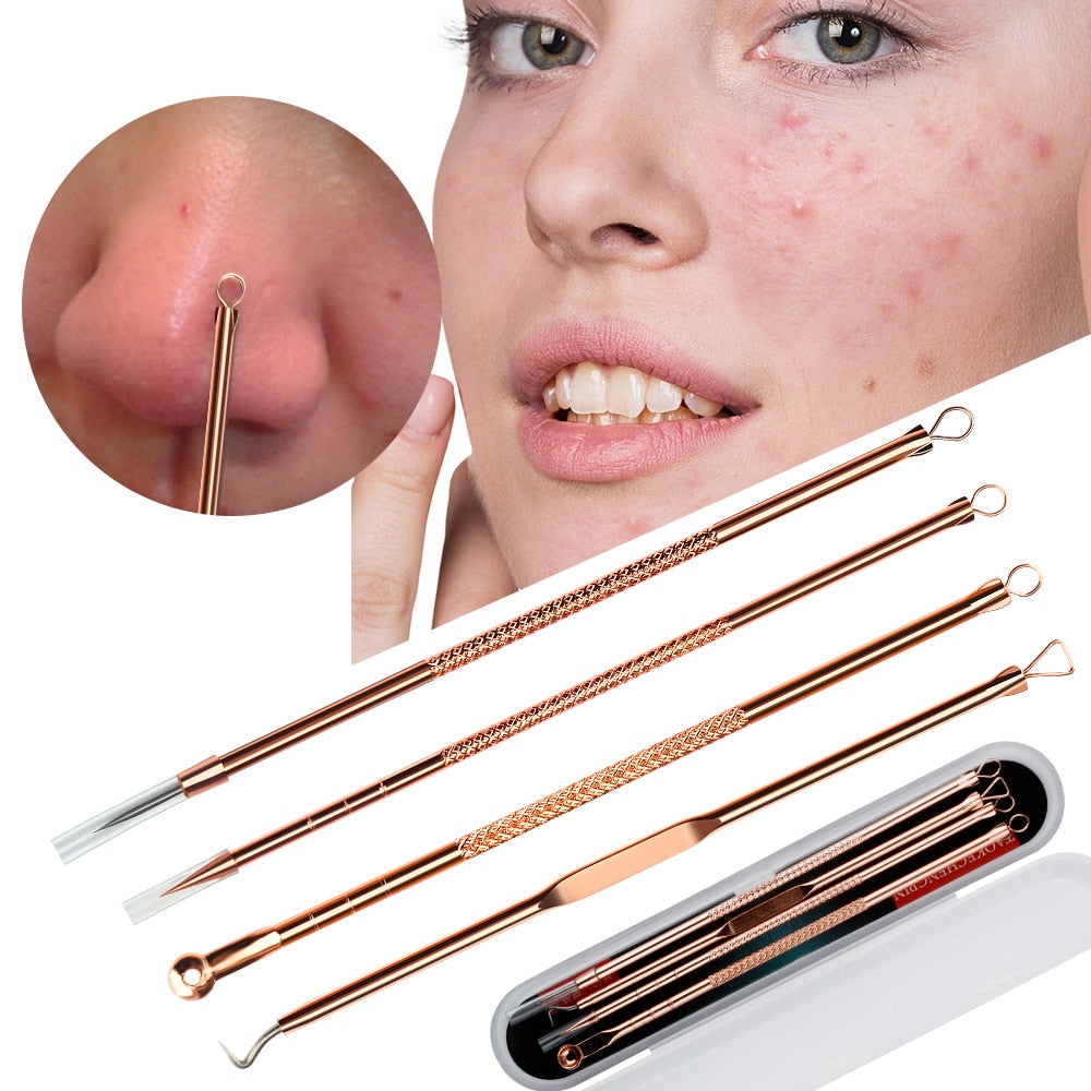 Rose Gold 4pcs/set Blackhead Comedone Acne Pimple Belmish Extractor / Blackhead Remover FREE GLOBAL DELIVERY